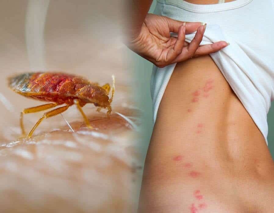 علاج مشكلة بق الفراش نهائياً